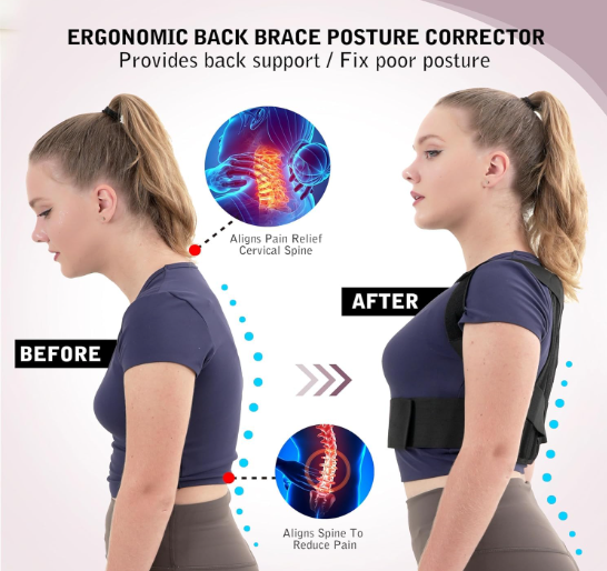 Adjustable Back Posture Corrector – Say Goodbye to Slouching!